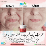 Age Revive Day Cream SPF 15 for all skin types Wrinkles + Pigmentation Treatment