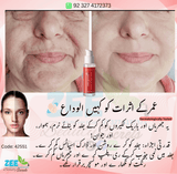 Age Revive Serum for all skin types Wrinkles + Pigmentation Treatment