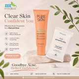 Glow Essential Soap & SOS blemish gel for all skin types