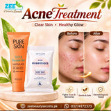 Glow Essential Soap & SOS blemish gel for all skin types