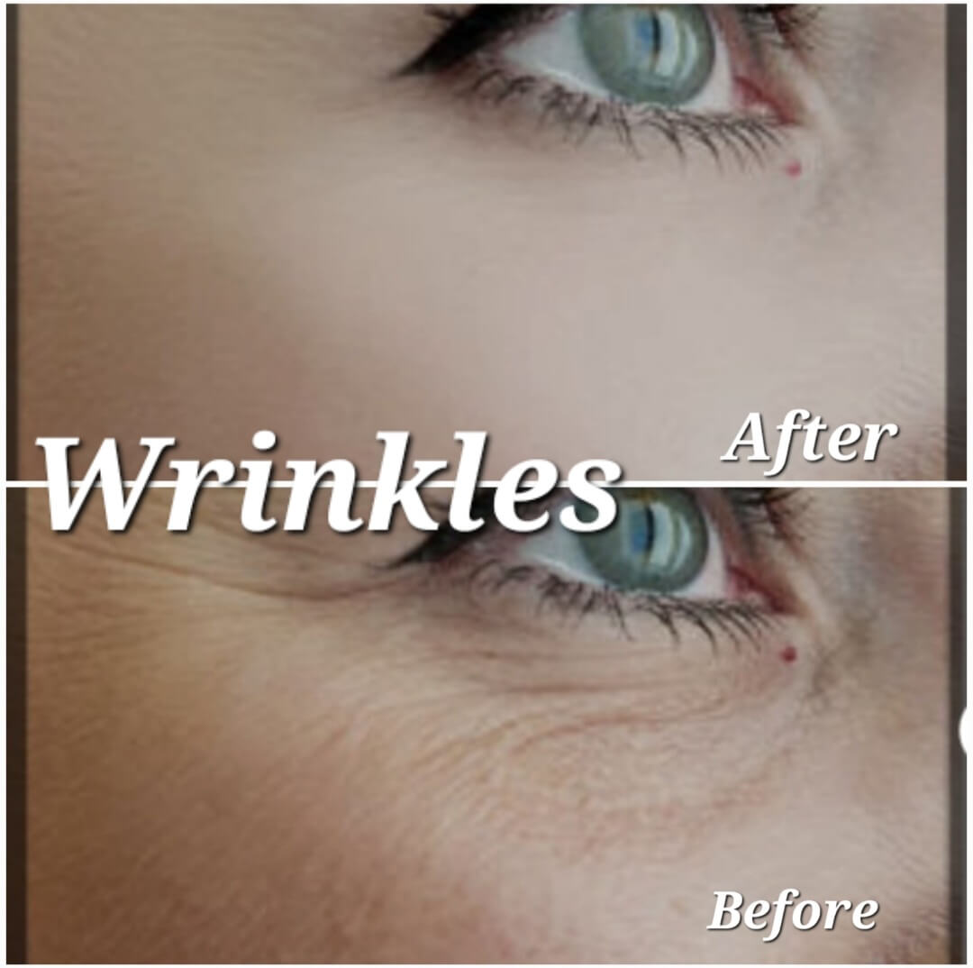 Age Revive Eye Cream  Wrinkles + Pigmentation Treatment