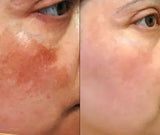 Optimal Age Revive Set, all skin types Wrinkles + Pigmentation Organic
