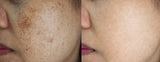 Optimal Age Revive Set, all skin types Wrinkles + Pigmentation Organic