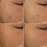 Oriflame Novage+ Blemish plus Age Defy Routine Light 5 Pics Set