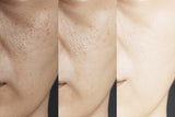 Age Revive Serum for all skin types Wrinkles + Pigmentation Treatment